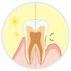 歯周病の予防法。「自分の歯を守るためにやるべきこと」とは？