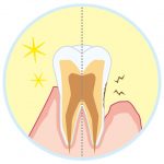 歯周病の予防法。「自分の歯を守るためにやるべきこと」とは？